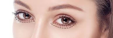 https://clinoraclinic.ghayatltd.com/wp-content/uploads/2026/06/materials/blepharoplasty/images-2-.jpeg