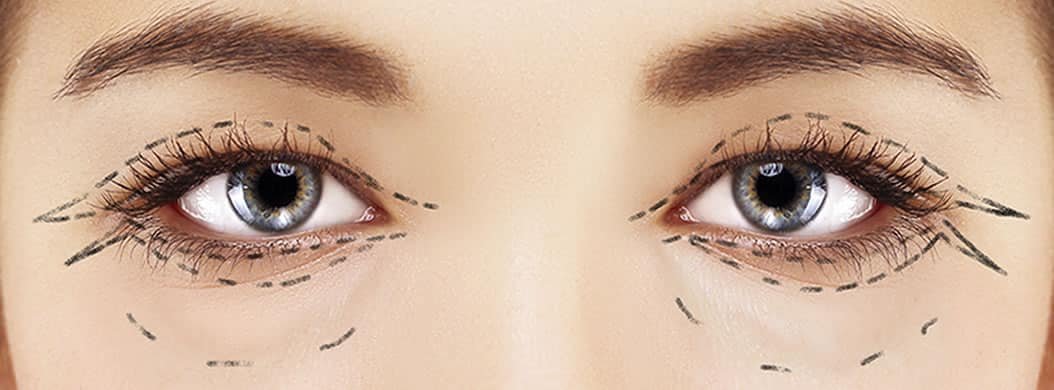 https://clinoraclinic.ghayatltd.com/wp-content/uploads/2026/06/materials/blepharoplasty/istock_000030989362_large-1.jpg