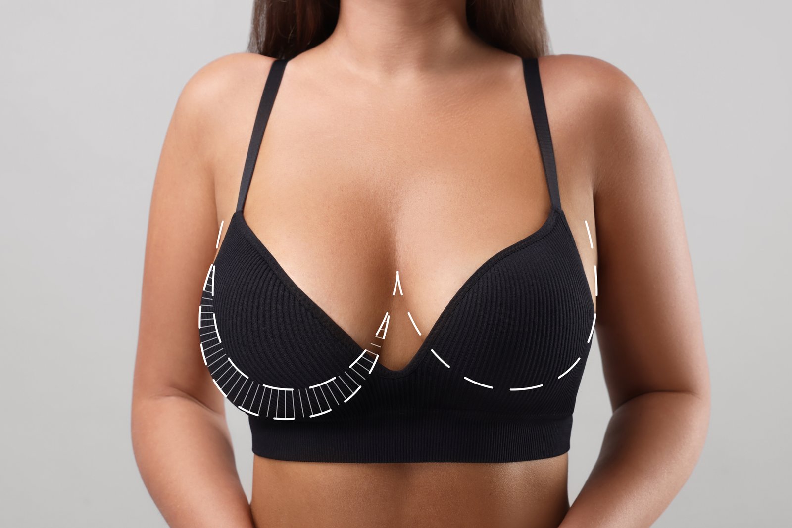 https://clinoraclinic.ghayatltd.com/wp-content/uploads/2026/06/materials/breast-reduction/shutterstock_2360976787.jpg