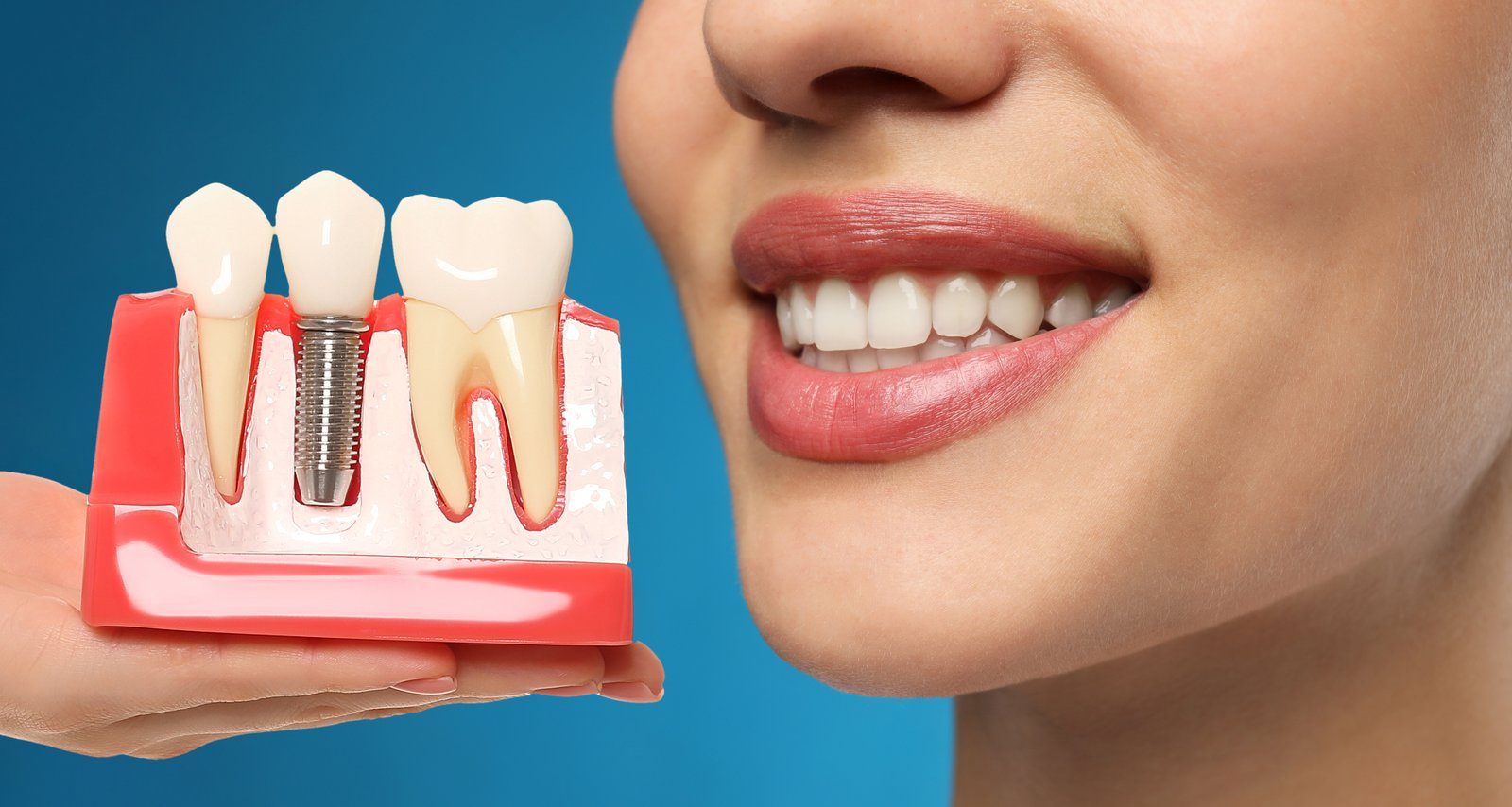 https://clinoraclinic.ghayatltd.com/wp-content/uploads/2026/06/materials/dental-imp/shutterstock_2228997547.jpg