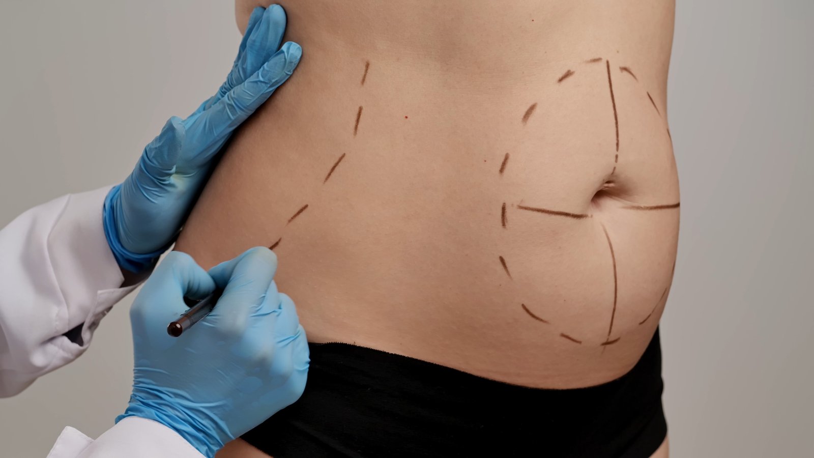 https://clinoraclinic.ghayatltd.com/wp-content/uploads/2026/06/materials/liposuction/shutterstock_2645161599.jpg