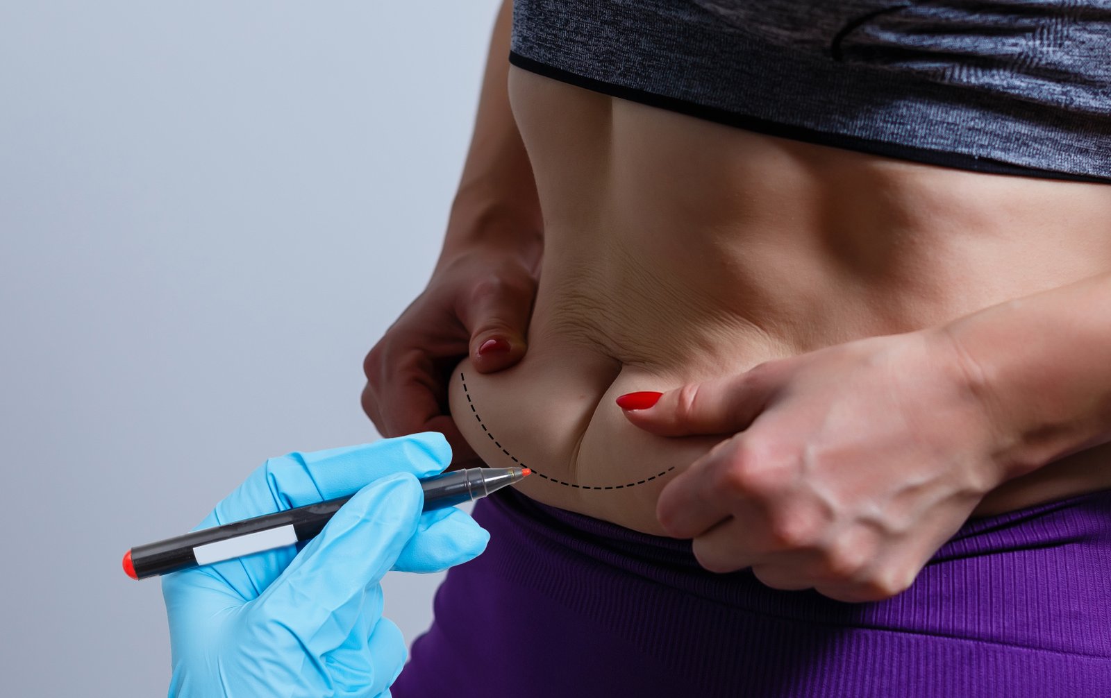 https://clinoraclinic.ghayatltd.com/wp-content/uploads/2026/06/materials/tummytuck/shutterstock_2174378539.jpg