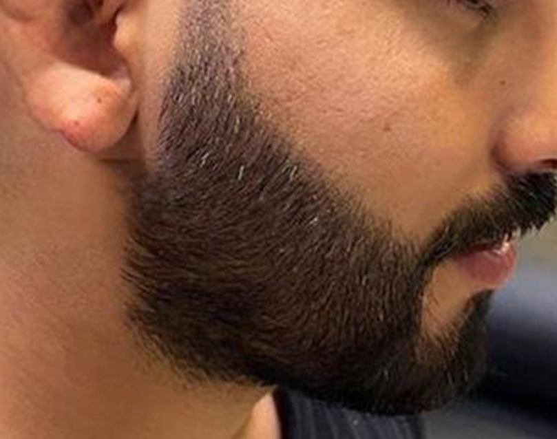 <span class="bt_bb_before_after_image_before_text">Before</span>
