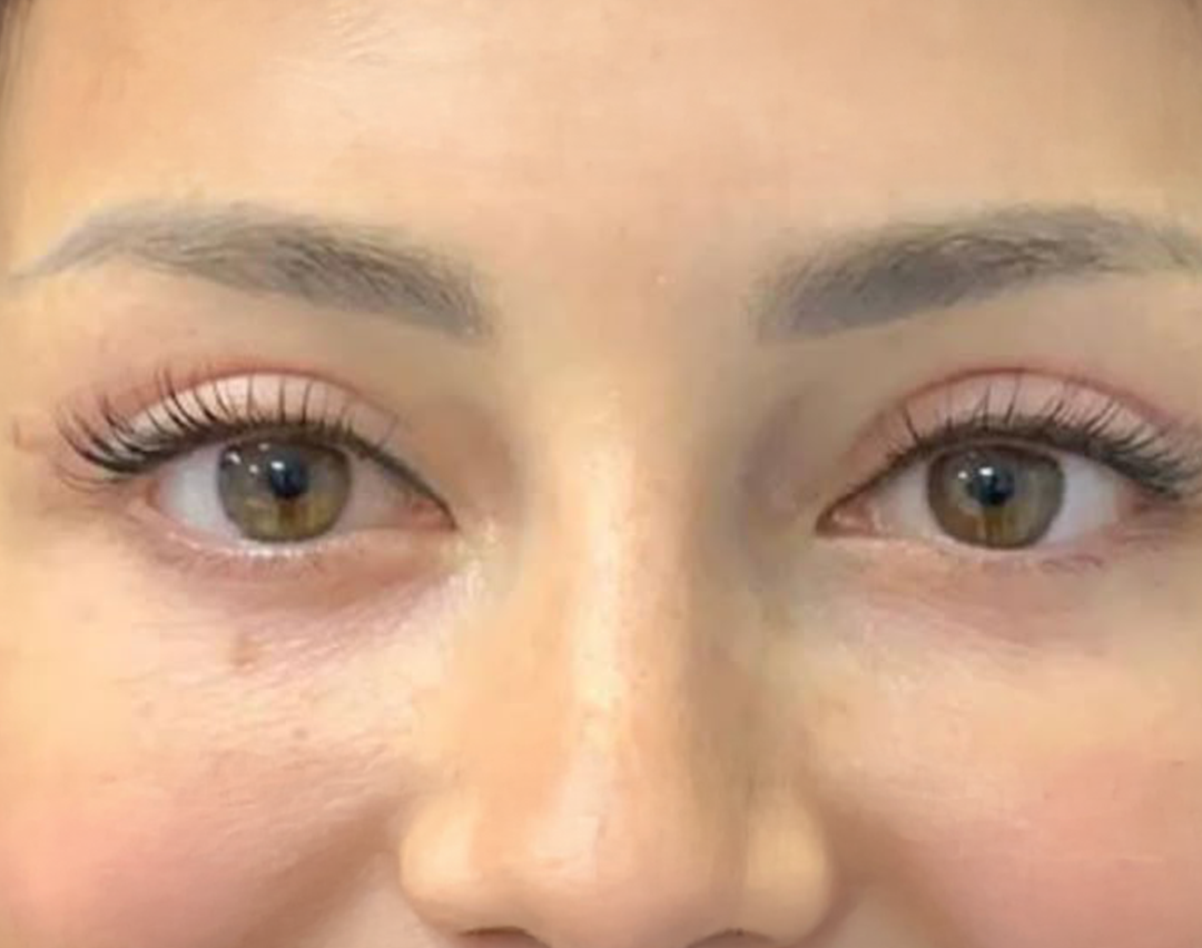 <span class="bt_bb_before_after_image_after_text">After</span>
