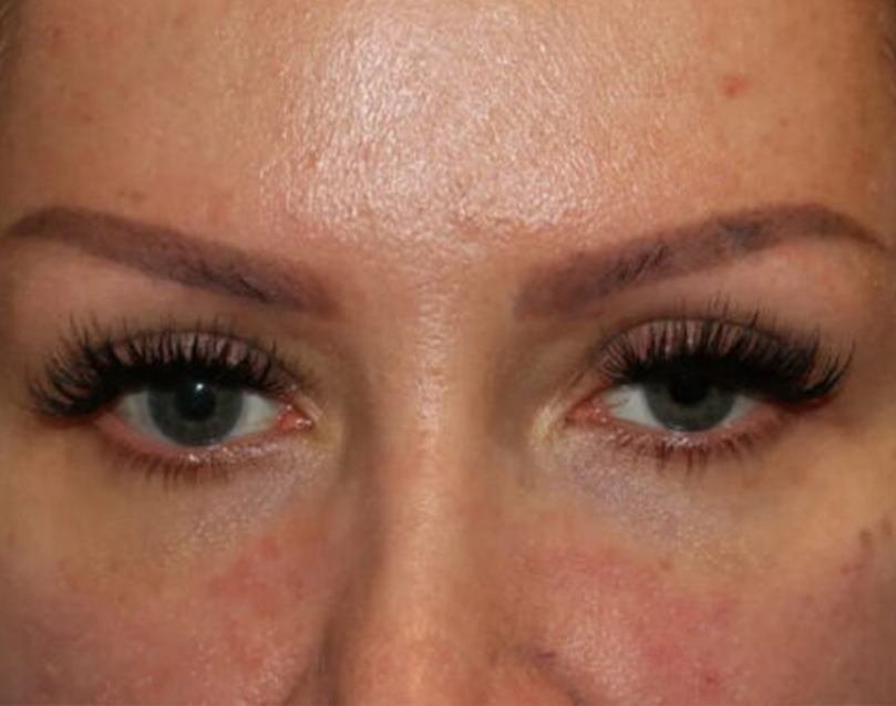 <span class="bt_bb_before_after_image_before_text">Before</span>