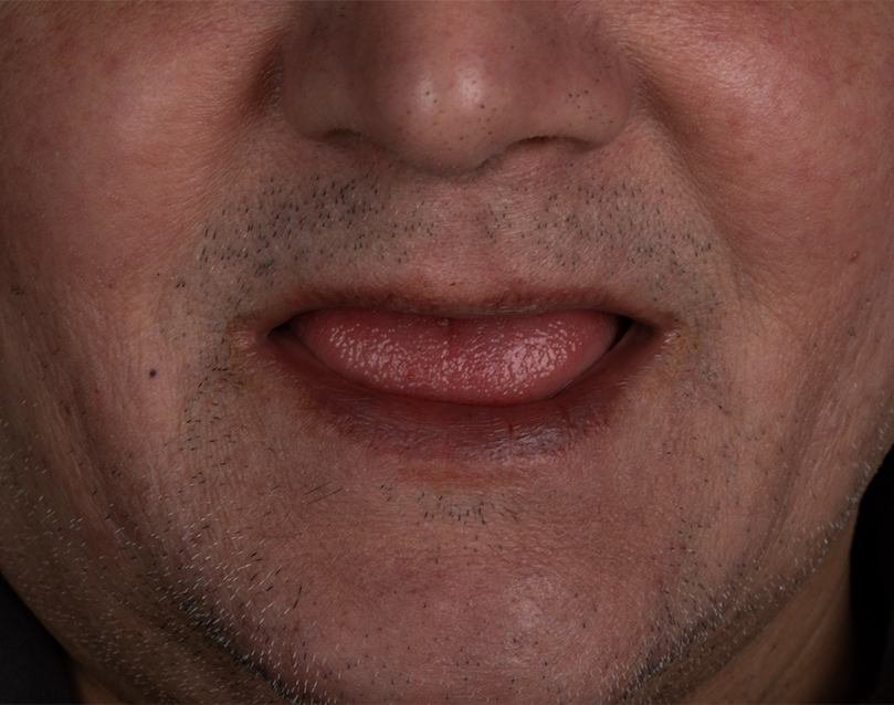<span class="bt_bb_before_after_image_before_text">Before</span>